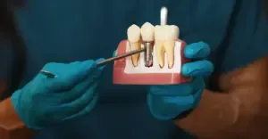 dental implants cost dubai, dental implants dubai, dental implants jlt, same day implants dubai